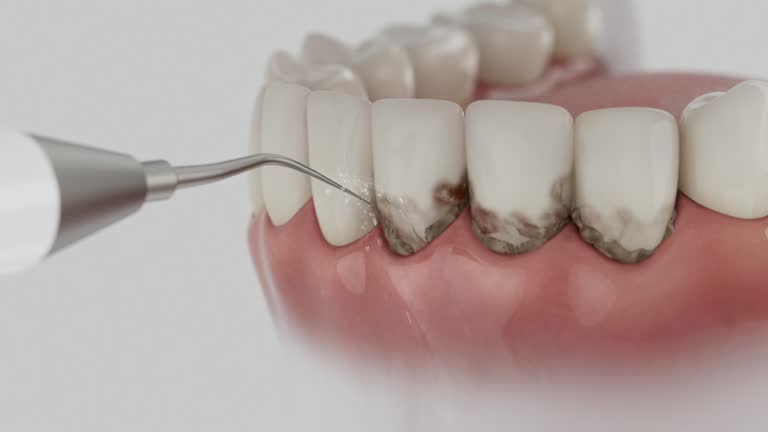 Reliable Dental contractor in Jackson, GA by Dentist Open Now
